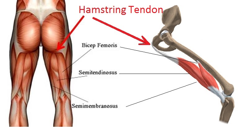 Hamstring Tendonitis and/or Piriformis Syndrome : r/bikinitalk